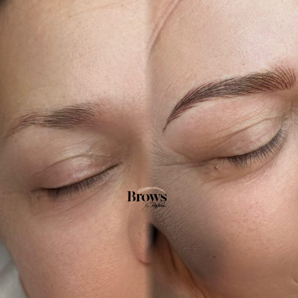 Before and after Nano Hair-Stroke Brows Romford London treatment