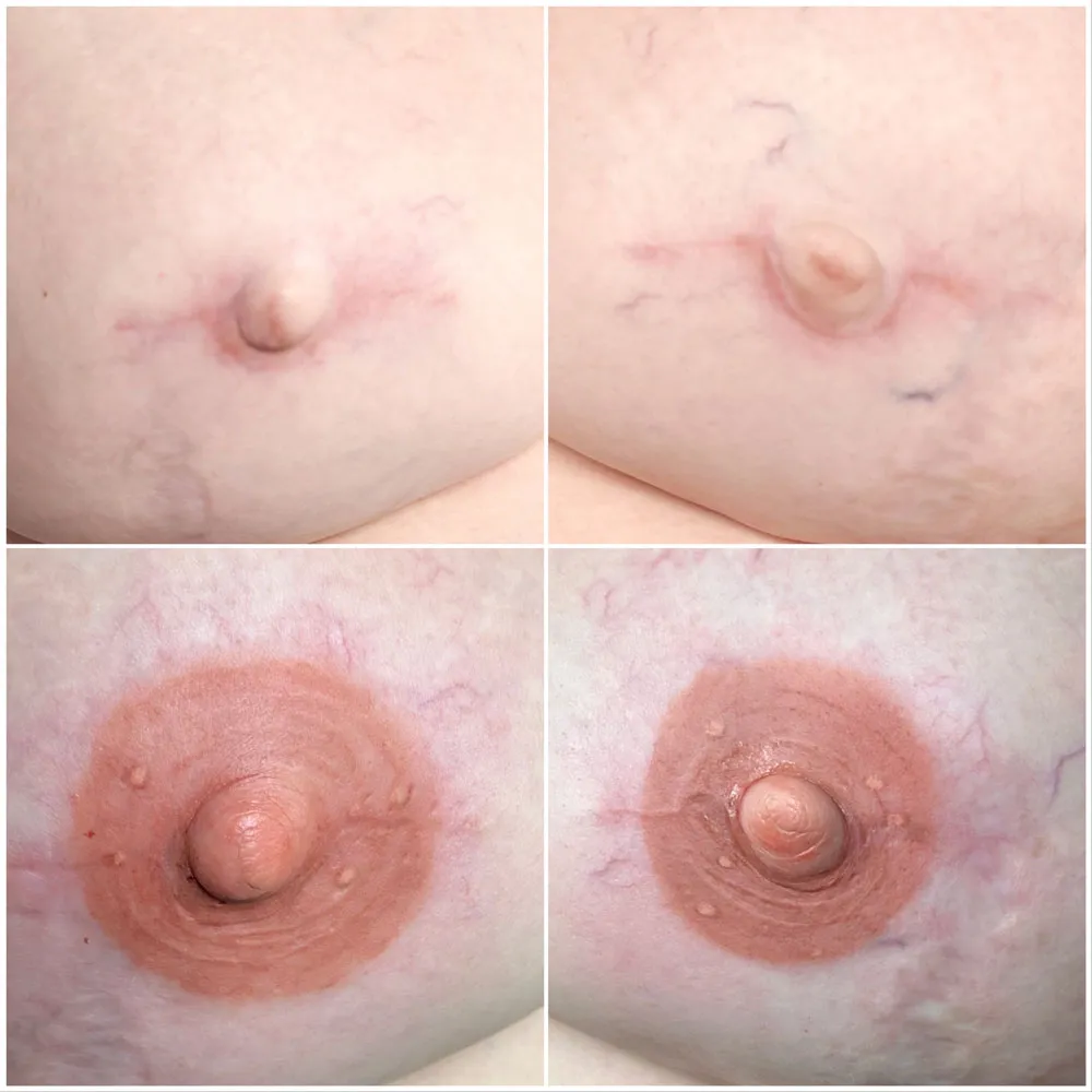 Areola Restoration and 3D Nipple Tattoo Romford London – SculptPMU by Mi