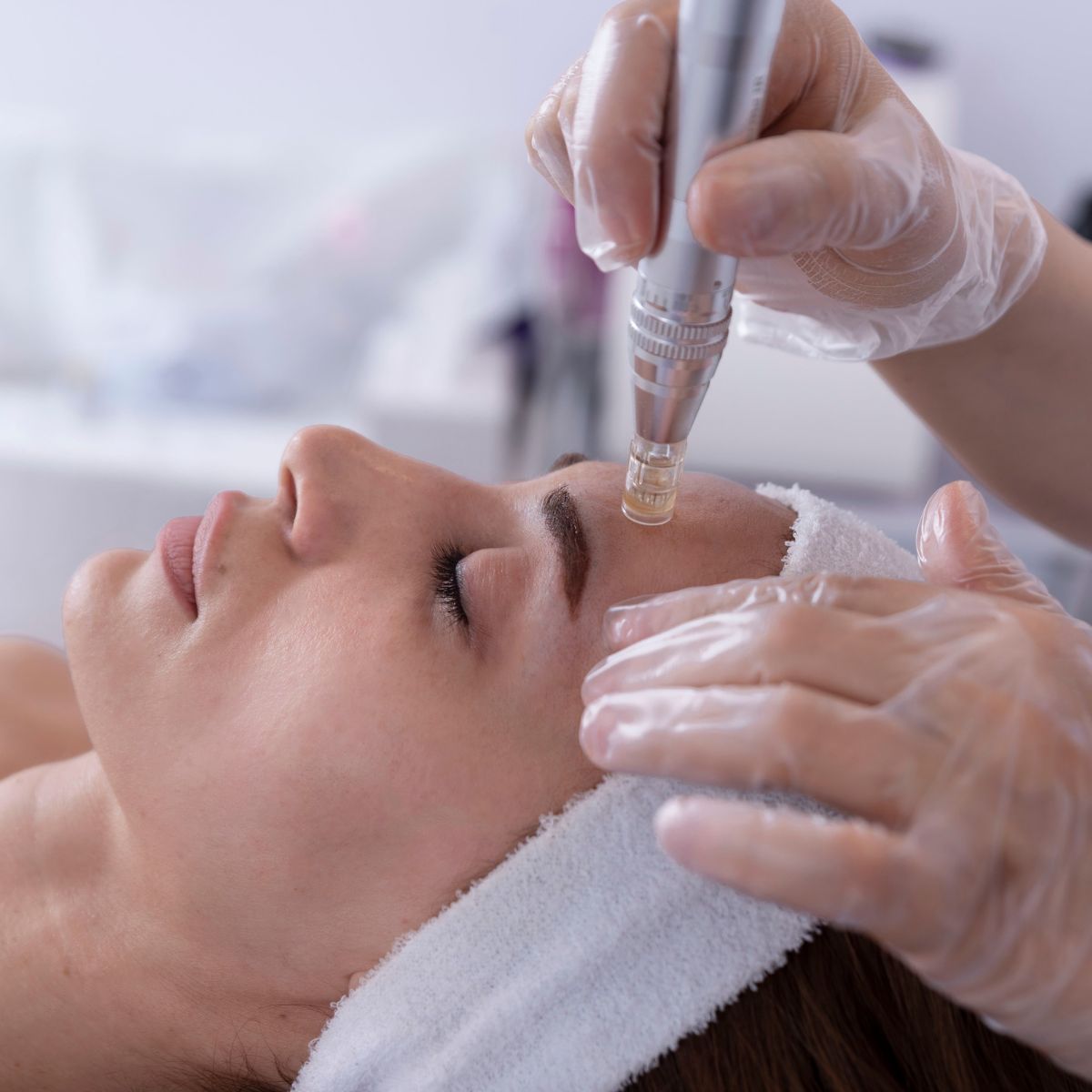 anti-aging microneedling