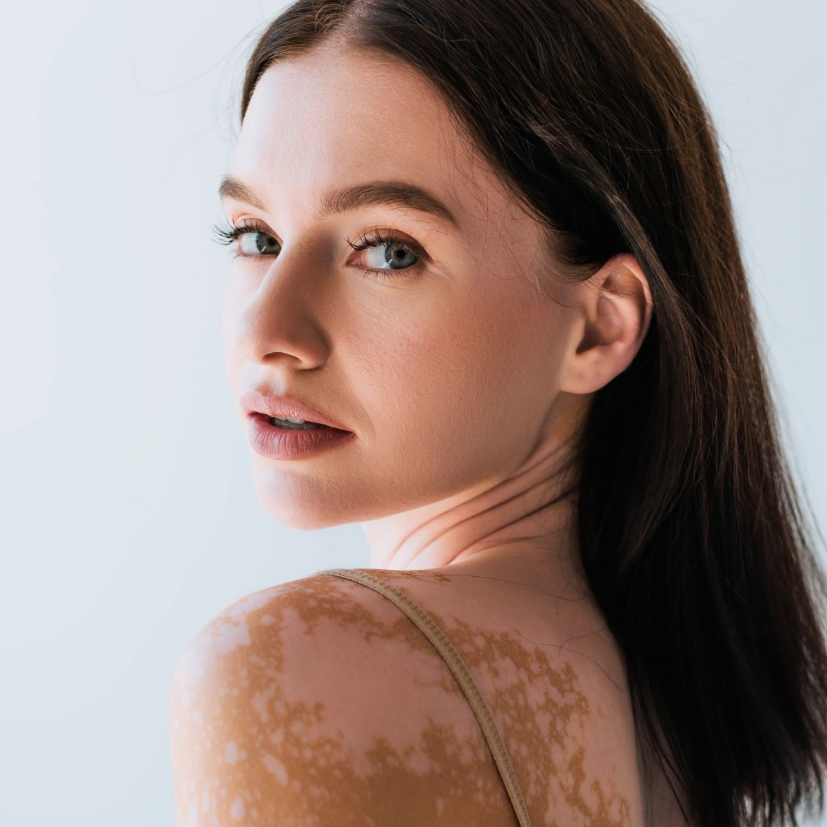 benefits of vitiligo camouflage
