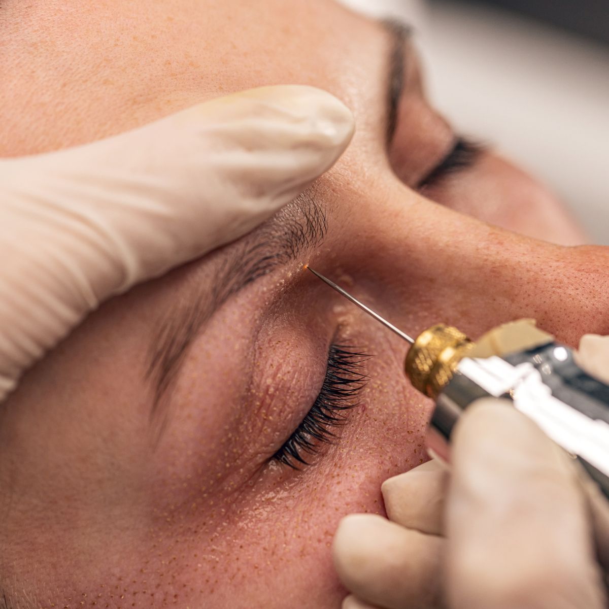 cost of skin treatments