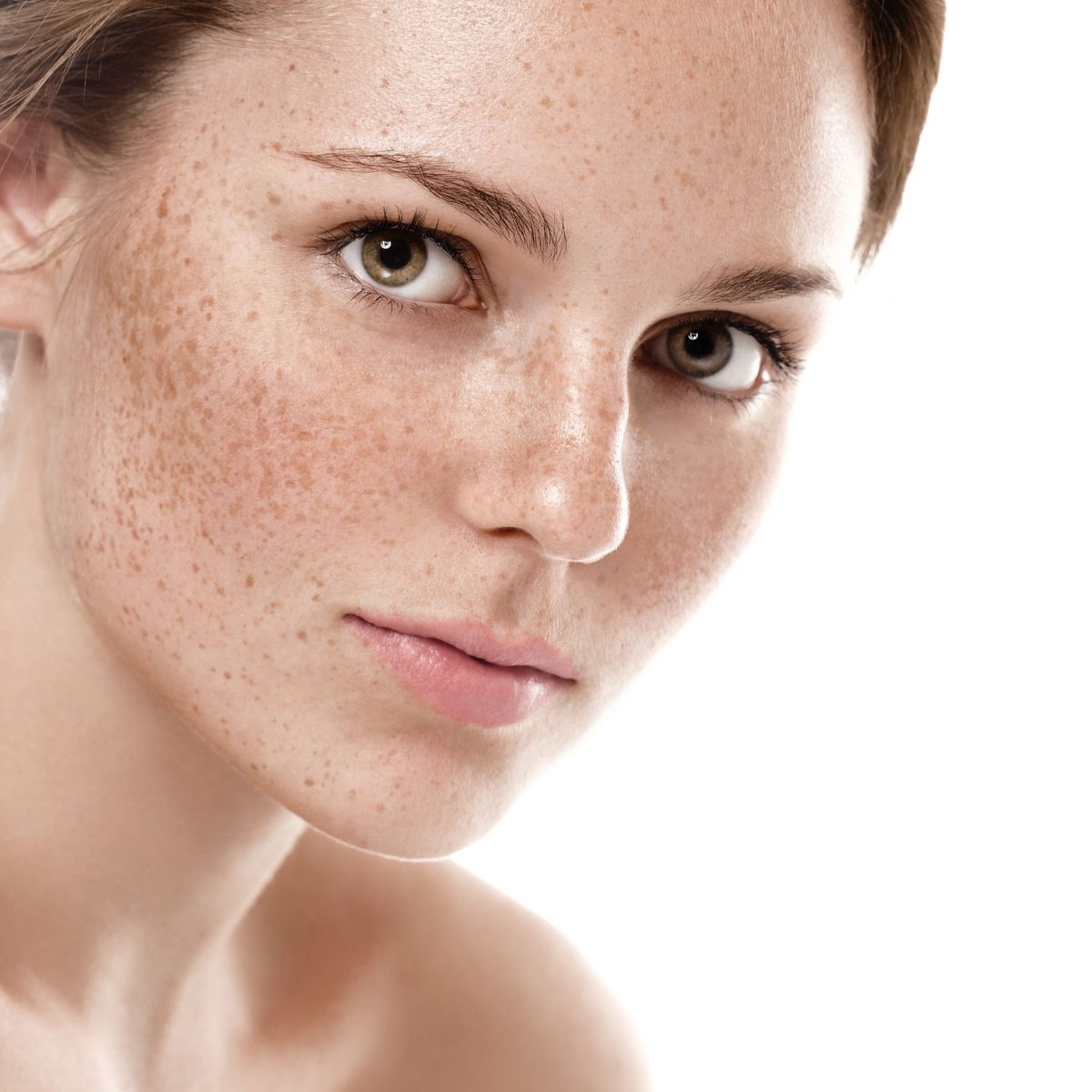 pigmentation & dark spot removal