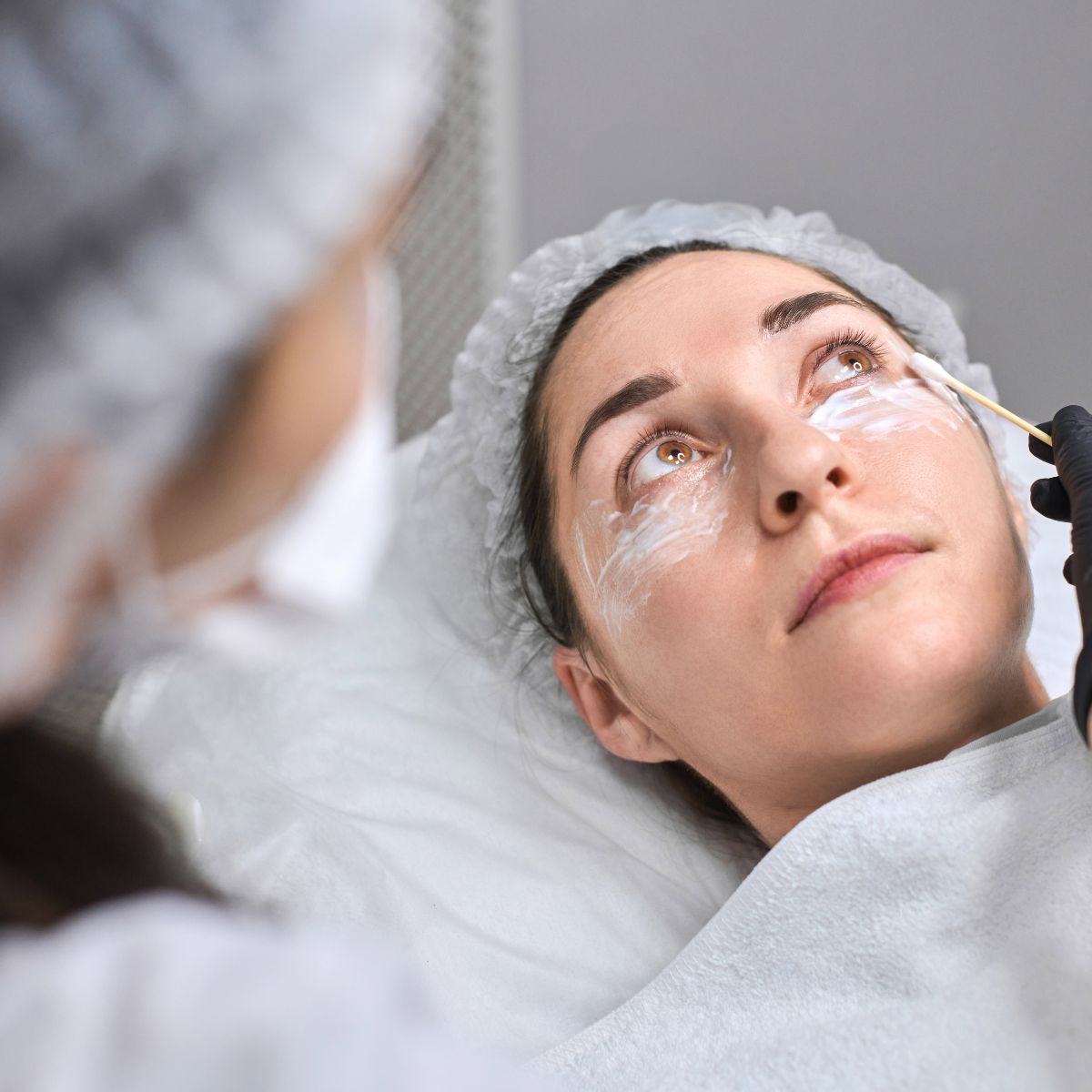 under-eye dark circle treatment