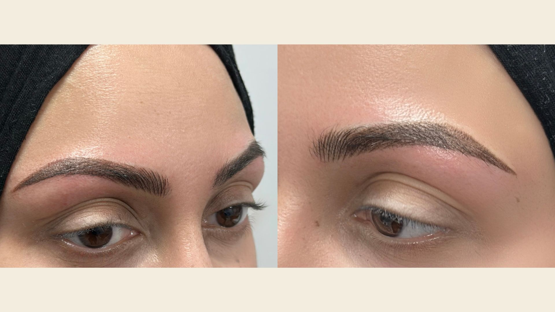 Nano brows create fine hairstrokes to give sparse brows a fuller, natural-looking appearance.